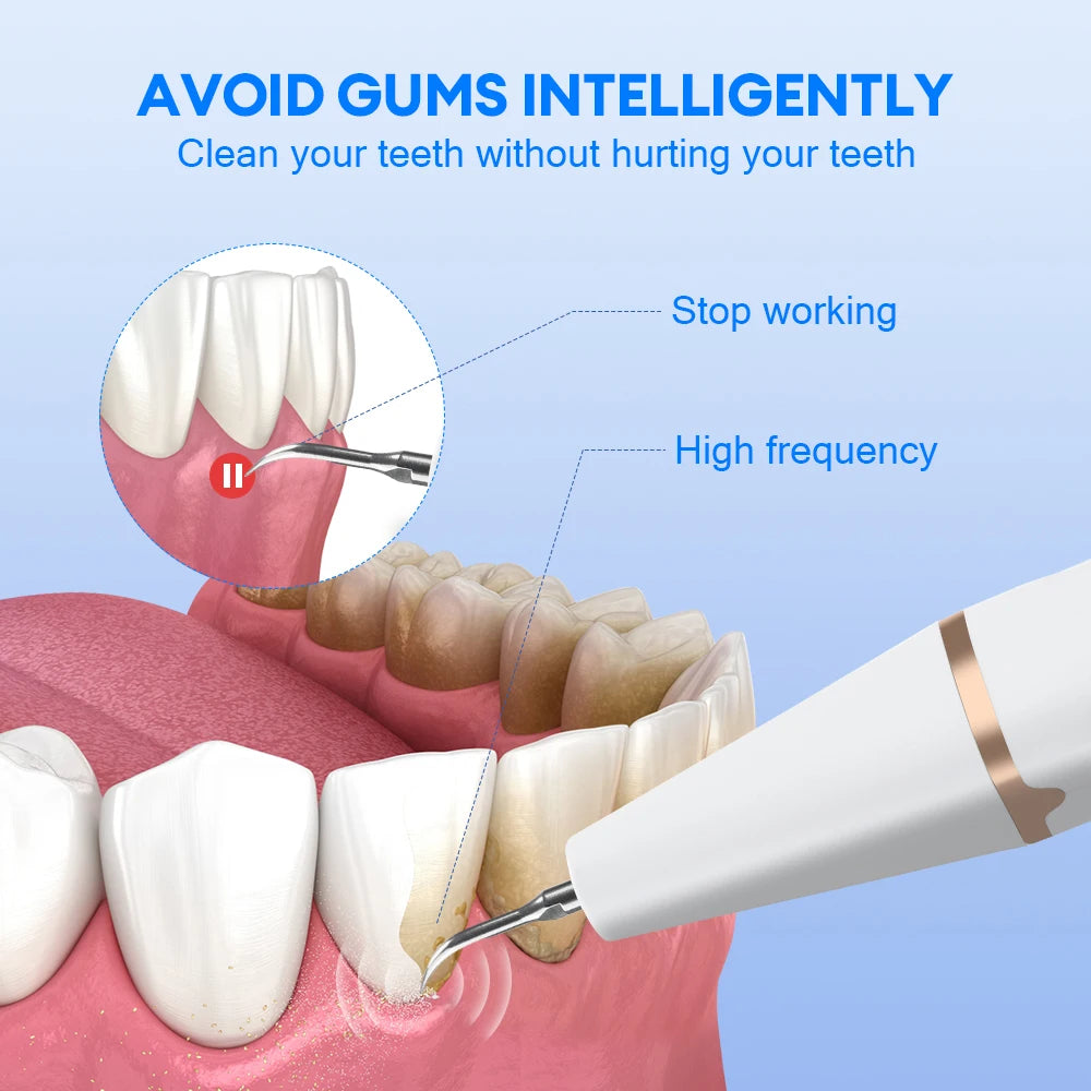 Ultrasonic Dental Cleaner for Tartar and Plaque Removal